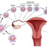 突破多囊卵巢综合征的认知壁垒：如何避免四大误区？