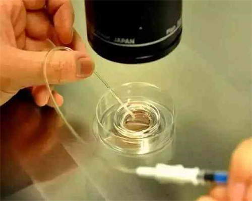 霉菌性阴道炎：详解四种核心治疗方法