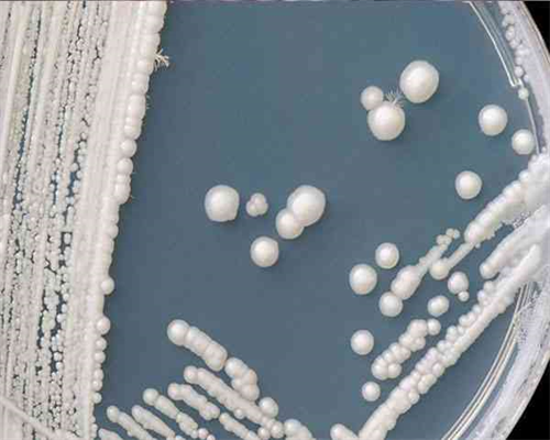 去济南山大生殖医院买精子做一次供精试管需要多少钱？