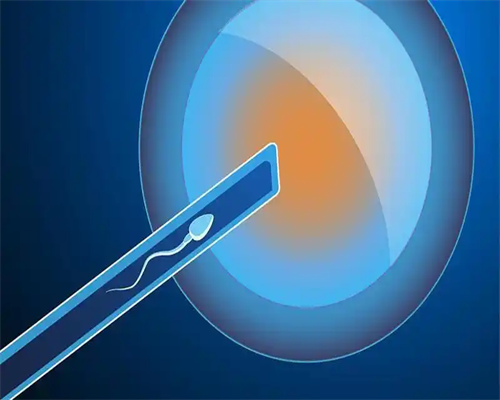 [精液常规怎么检查]怎么做精液常规检查