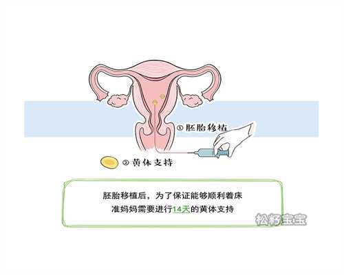 宫颈肥大引发下腹痛：我们能否成功逆转？