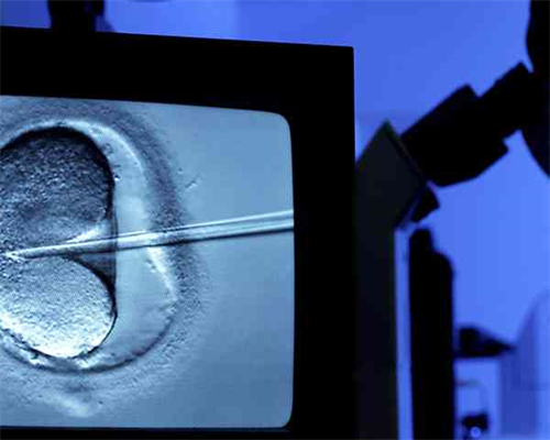 女性染色体45x可以做试管吗