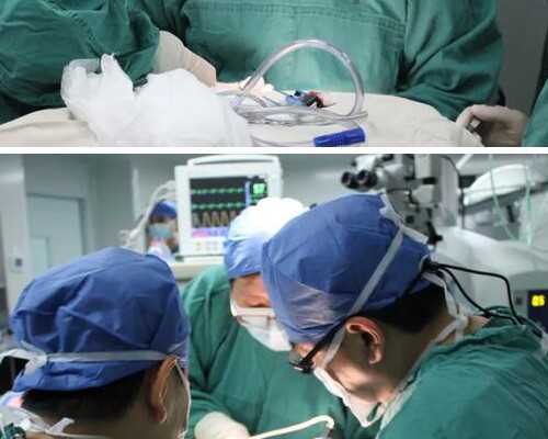 揭示神秘“卵巢囊肿”：全面解析与应对策略