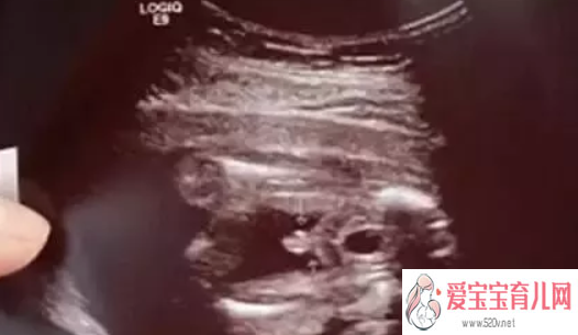 济南代生子qq群，2019年3月13日受孕生男生女怎么看农历二月初七怀孕是男孩还是